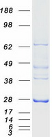 protp27144 ak3l1 ak4 human recombinant protein