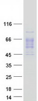 Coomassie blue staining of purified IL1R2 protein