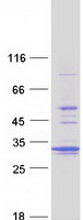 Coomassie blue staining of purified PSMA5 protein