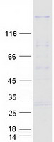 Coomassie blue staining of purified ITPRID2 protein