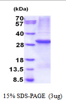 protp29074 sdspage human ptpn4 recombinant protein