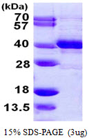 3ug by SDS-PAGE under reducing condition and visualized by coomassie blue stain
