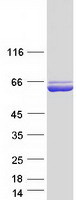 protp30038 aldh4a1 human recombinant protein
