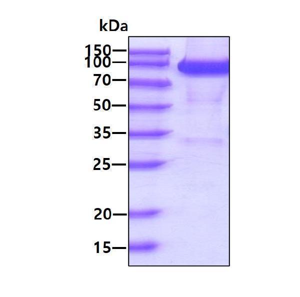 3ug by SDS-PAGE under reducing condition and visualized by coomassie blue stain