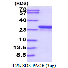 protp30711 sdspage human glutathione s transferase theta 1 gstt1 recombinant protein