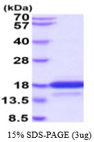 3ug by SDS-PAGE under reducing condition and visualized by coomassie blue stain.