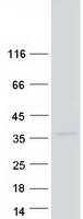 protp31274 hoxc9 human recombinant protein