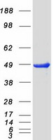 Coomassie blue staining of purified PRKAR2B protein