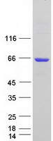 Coomassie blue staining of purified AKT1 protein