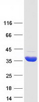 protp31937 hibadh human recombinant protein