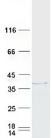 Coomassie blue staining of purified HNRNPH3 protein