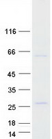 Coomassie blue staining of purified FOXN2 protein