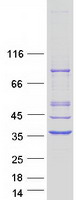protp32322 pycr1 human recombinant protein