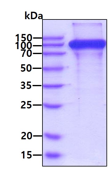 3ug by SDS-PAGE under reducing condition and visualized by coomassie blue stain