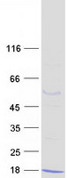 Coomassie blue staining of purified S100A5 protein