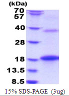 3ug by SDS-PAGE under reducing condition and visualized by coomassie blue stain