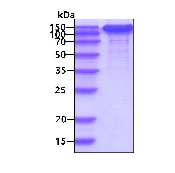3ug by SDS-PAGE under reducing condition and visualized by coomassie blue stain