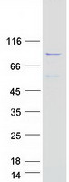protp35612 adducin 2 add2 human recombinant protein