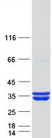 Coomassie blue staining of purified HMGCL protein