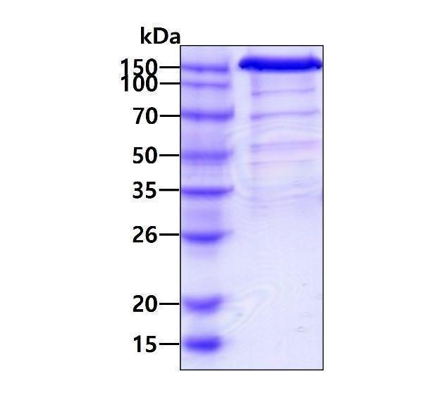 3ug by SDS-PAGE under reducing condition and visualized by coomassie blue stain
