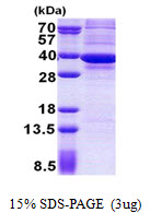 3ug by SDS-PAGE under reducing condition and visualized by coomassie blue stain.
