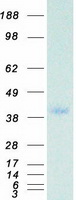 protp36873 pp1c gamma ppp1cc human recombinant protein