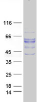 protp36894 bmpr1a human recombinant protein