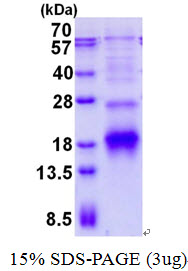 3ug by SDS-PAGE under reducing condition and visualized by coomassie blue stain.