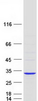protp38117 etfb human recombinant protein