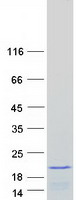 Coomassie blue staining of purified RPS19 protein