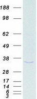 Coomassie blue staining of purified ANP32A protein
