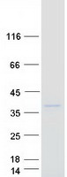 Coomassie blue staining of purified CEACAM3 protein