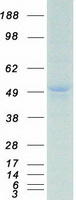 Coomassie blue staining of purified PBX1 protein