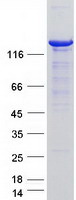 Coomassie blue staining of purified USP8 protein