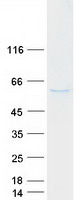 Coomassie blue staining of purified MNDA protein