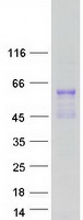 protp41235 hnf 4 alpha hnf4a human recombinant protein