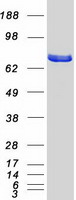 Coomassie blue staining of purified GARS protein