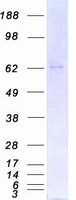 Coomassie blue staining of purified PRKCI protein