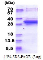 3ug by SDS-PAGE under reducing condition and visualized by coomassie blue stain.