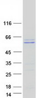 Coomassie blue staining of purified TMPO protein