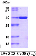 3ug by SDS-PAGE under reducing condition and visualized by coomassie blue stain
