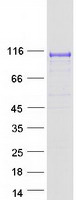 Coomassie blue staining of purified DPP6 protein