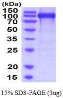 protp42702 sdspage human lif r alpha recombinant protein
