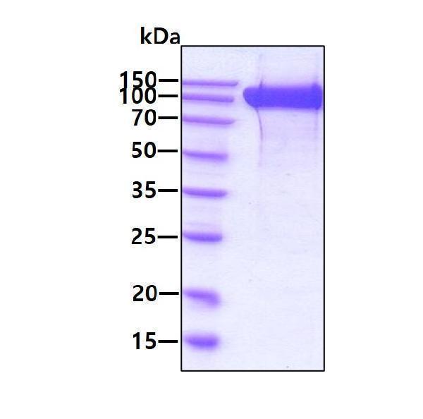 3ug by SDS-PAGE under reducing condition and visualized by coomassie blue stain