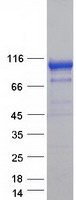protp42892 ece1 human recombinant protein