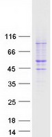 Coomassie blue staining of purified PAFAH1B1 protein