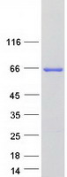 protp43155 crat human recombinant protein
