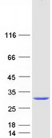 Coomassie blue staining of purified CRYBB2 protein