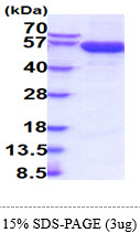 3ug by SDS-PAGE under reducing condition and visualized by coomassie blue stain