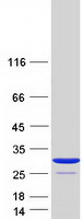 Coomassie blue staining of purified CRK protein
